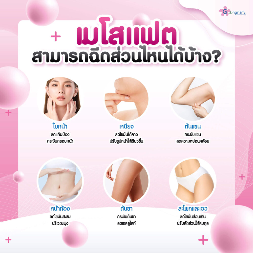 ตำแหน่ง ฉีดเมโสแฟต