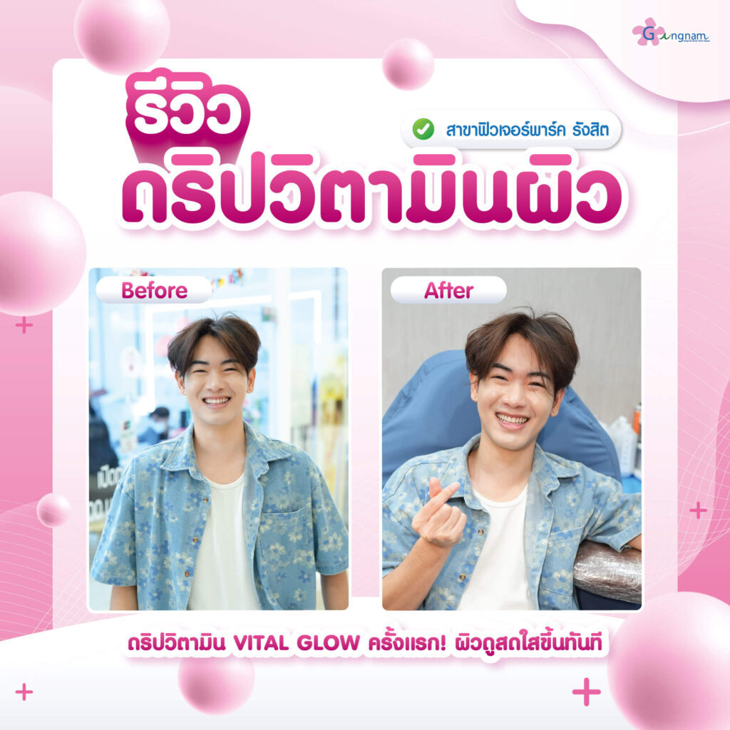 รีวิว ดริปวิตามินผิว ผู้ชาย