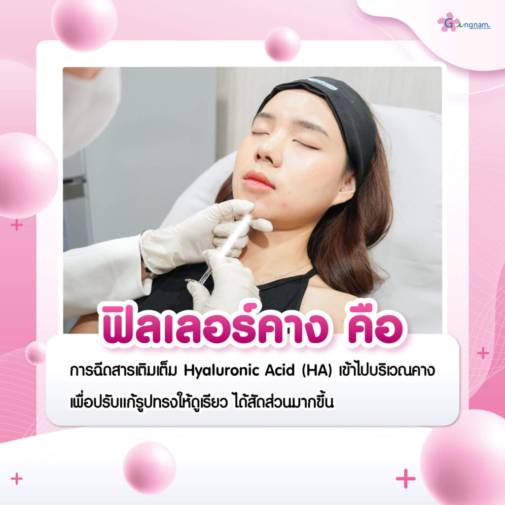 ฟิลเลอร์คาง