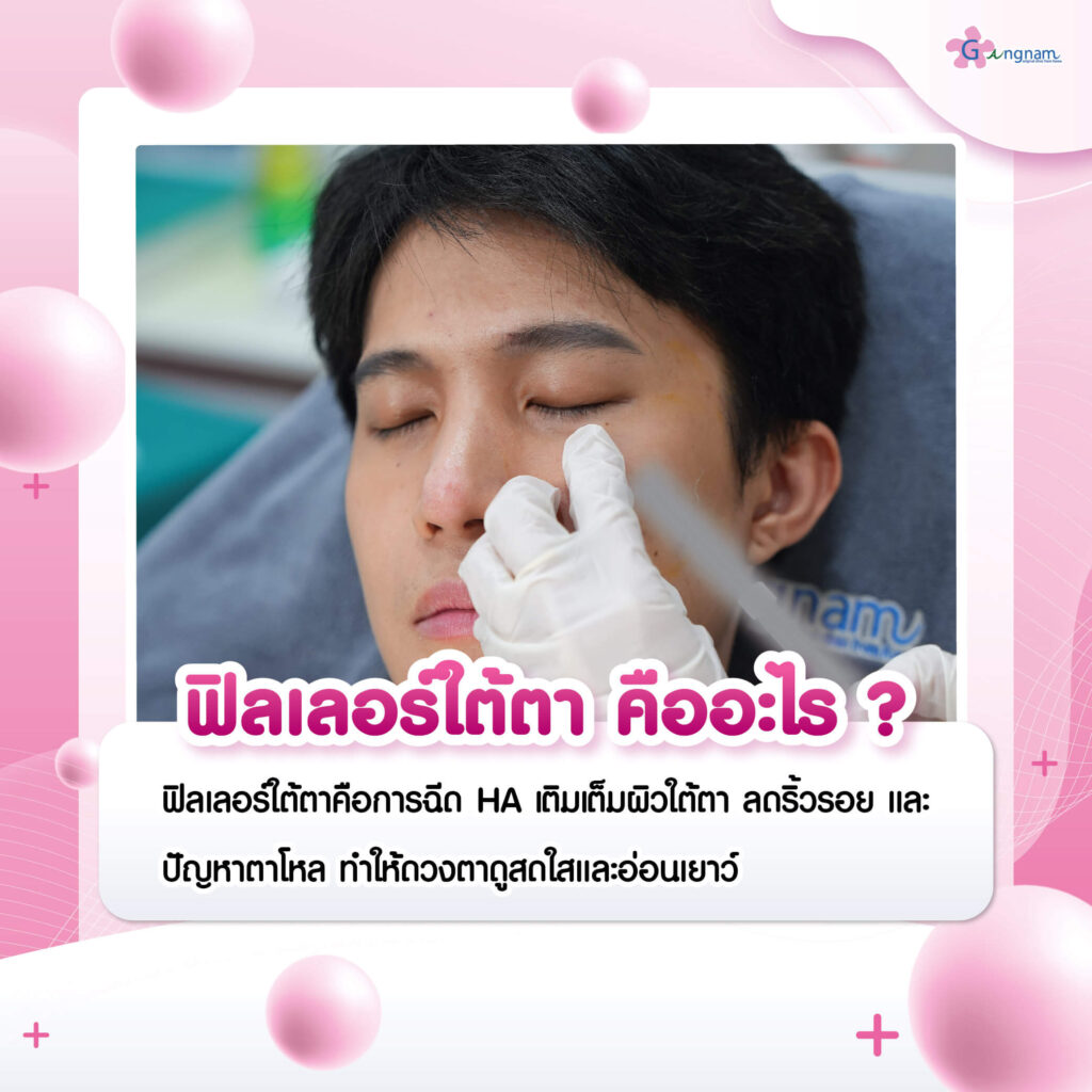 ฟีลเลอร์ใต้ตา