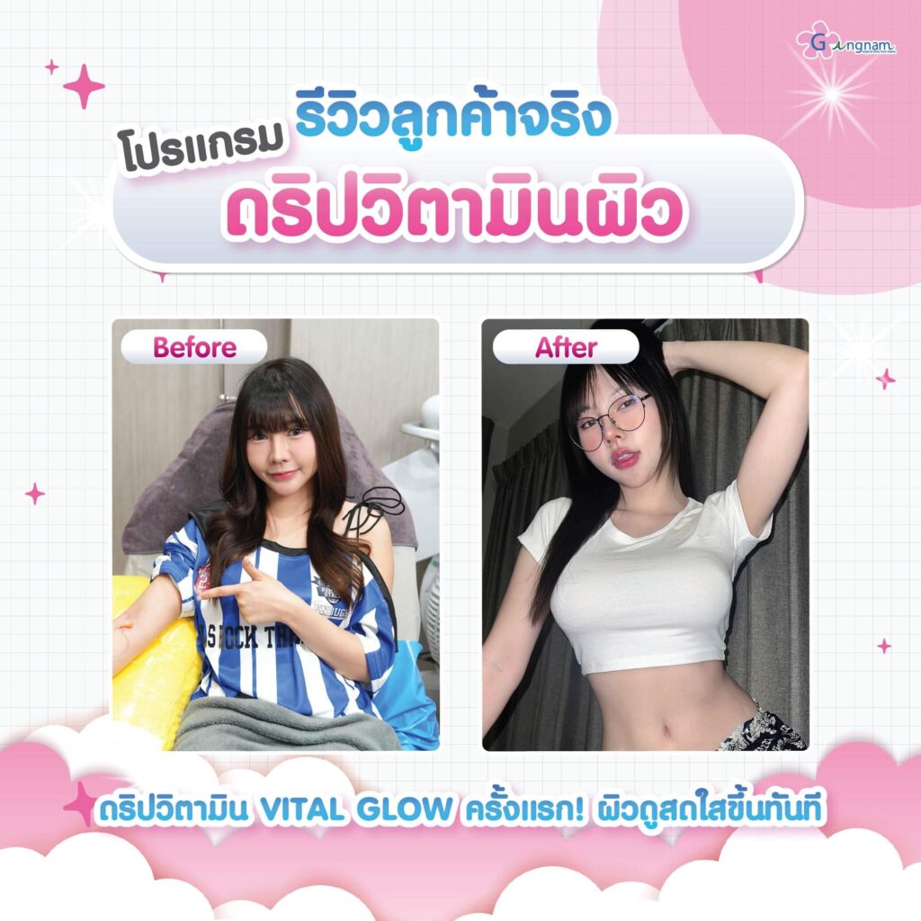 รีวิว ดริปวิตามินผิว Gangnam Clinic